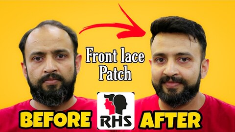 Rizy Hair Solution in Andheri West, mumbai Rizy Hair Solution in Andheri West, mumbai