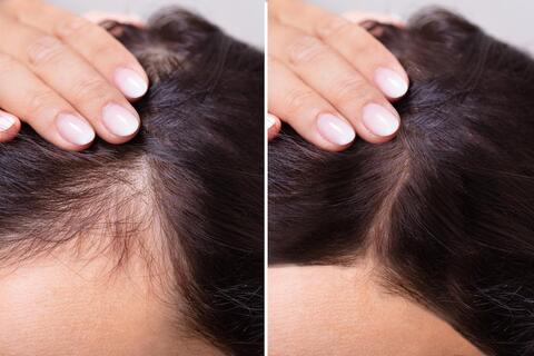 CPLSS Mumbai- Cosmetic Surgeon in Santacruz West - Best Laser Hair Removal Treatment in Mumbai - Justdial CPLSS Mumbai- Cosmetic Surgeon in Santacruz West - Best Laser Hair Removal Treatment in Mumbai - Justdial