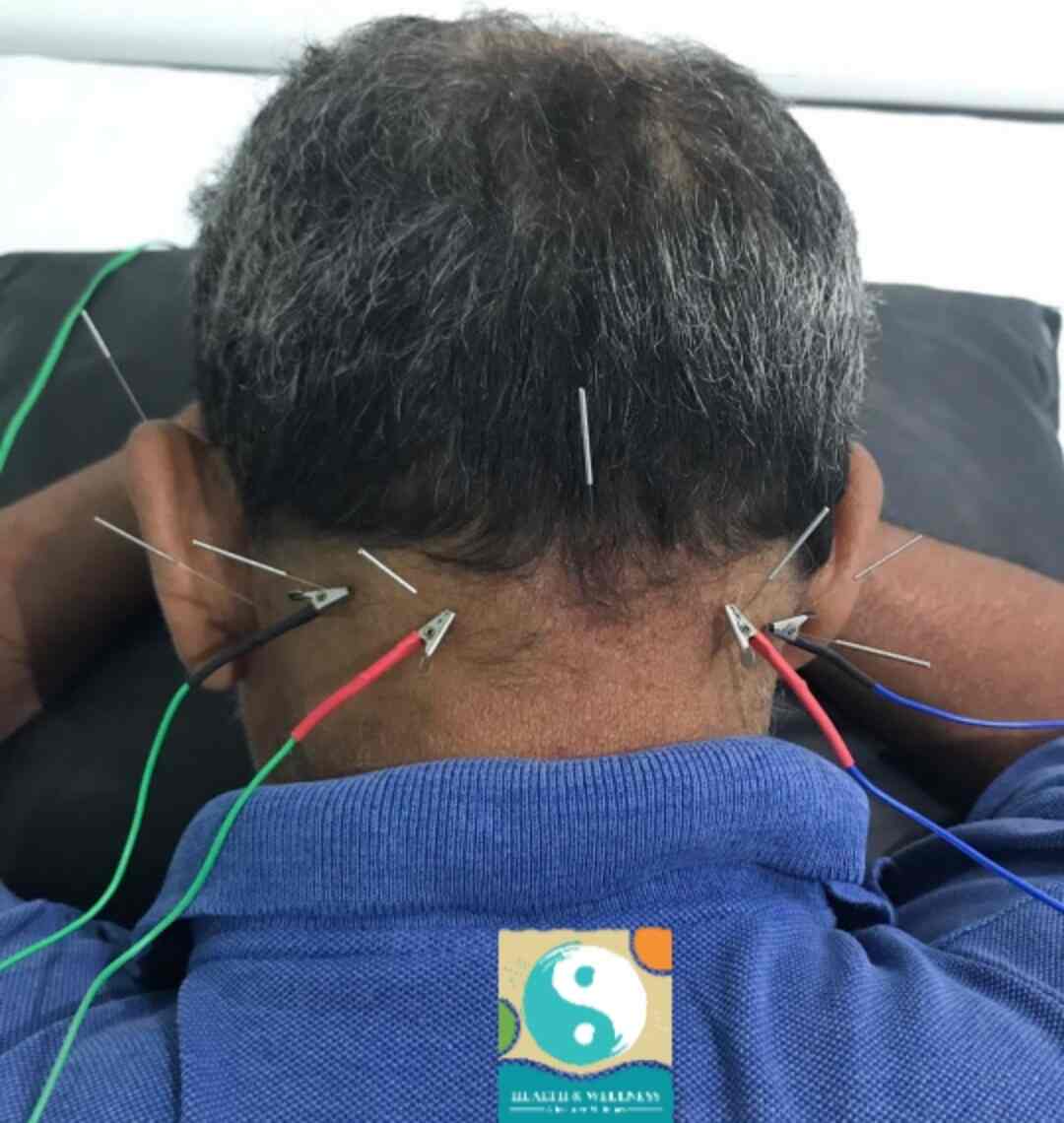 Dr. Husain R k in Dadar East,Mumbai Best Acupuncture Doctors in Mumbai Justdial