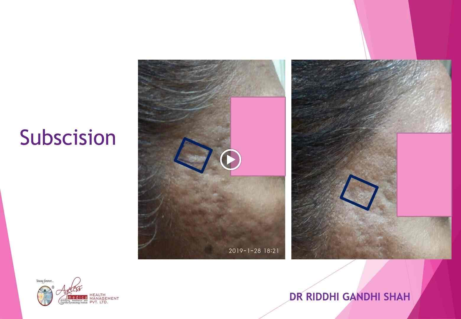 Top Dermatologists in AsalfaGhatkopar West, Mumbai Best Skin