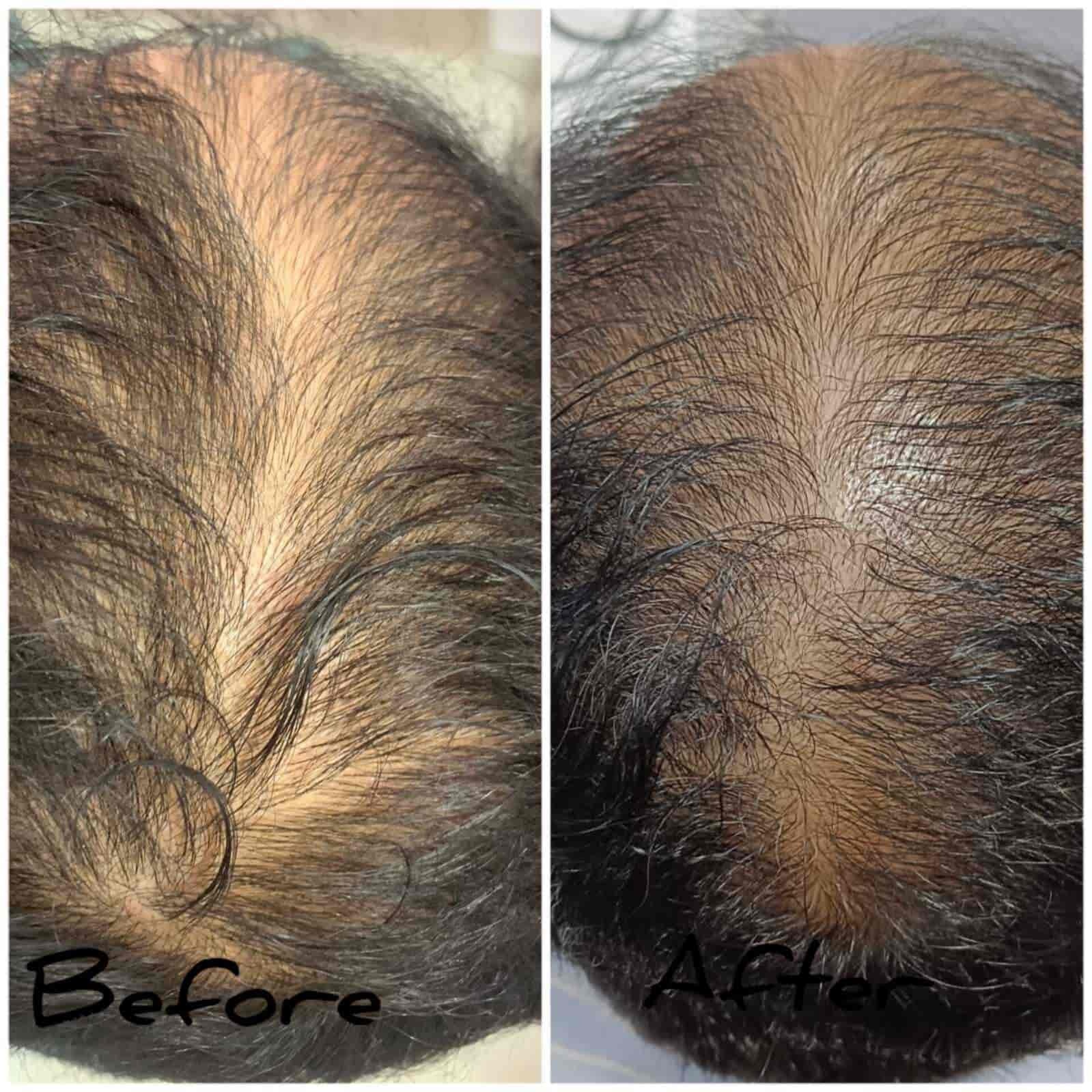 Lylac Beauty & Aesthetic Clinic in Goregaon West,Mumbai Book