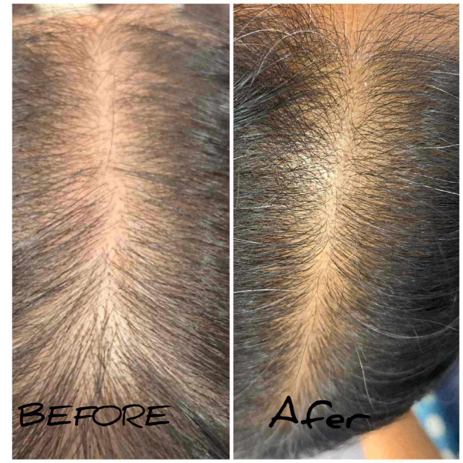 Lylac Beauty & Aesthetic Clinic in Goregaon West,Mumbai Book