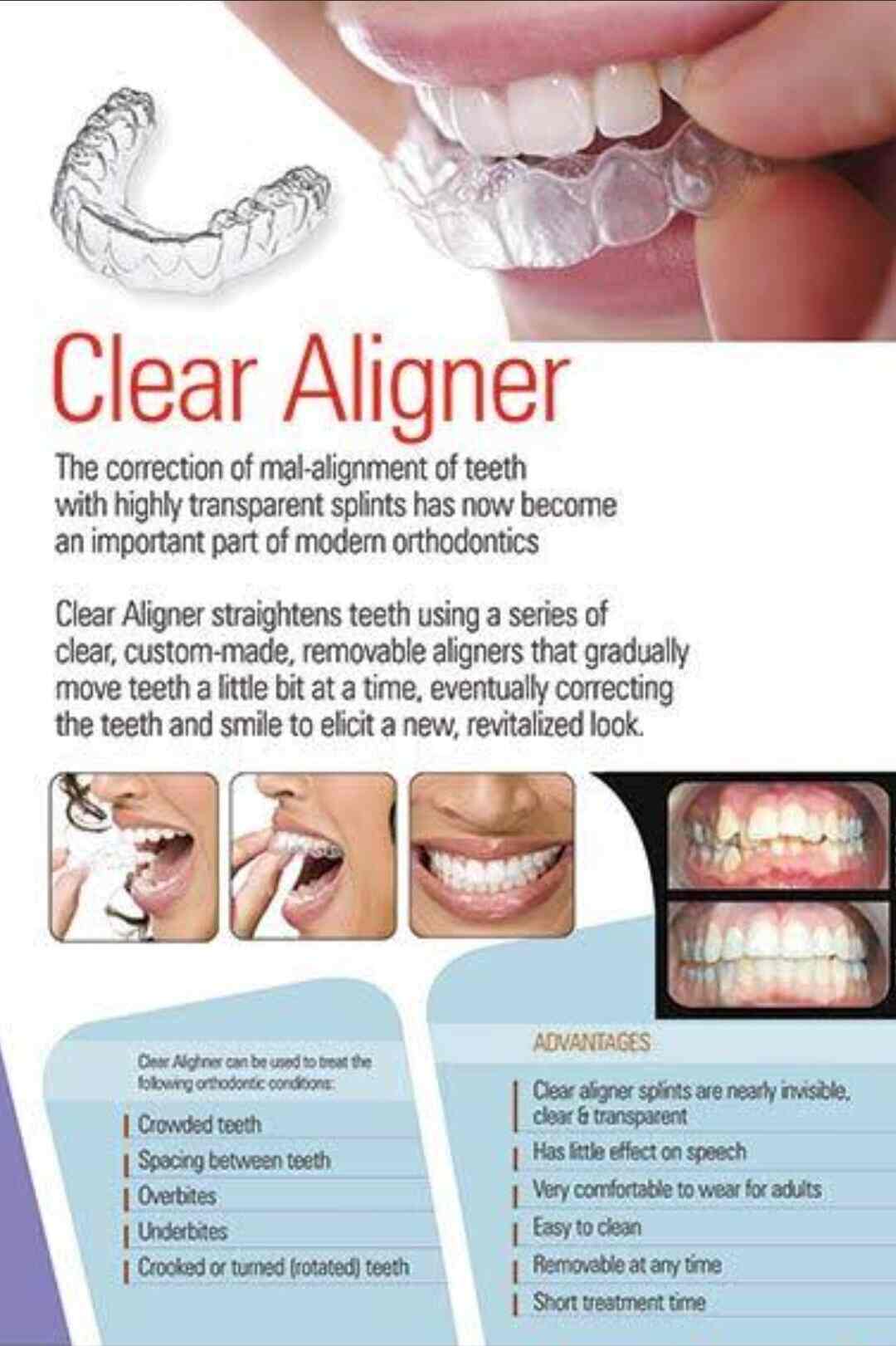 Dr. Nikita Patil Dental Clinic in Kandivali West,Mumbai Best Dentists