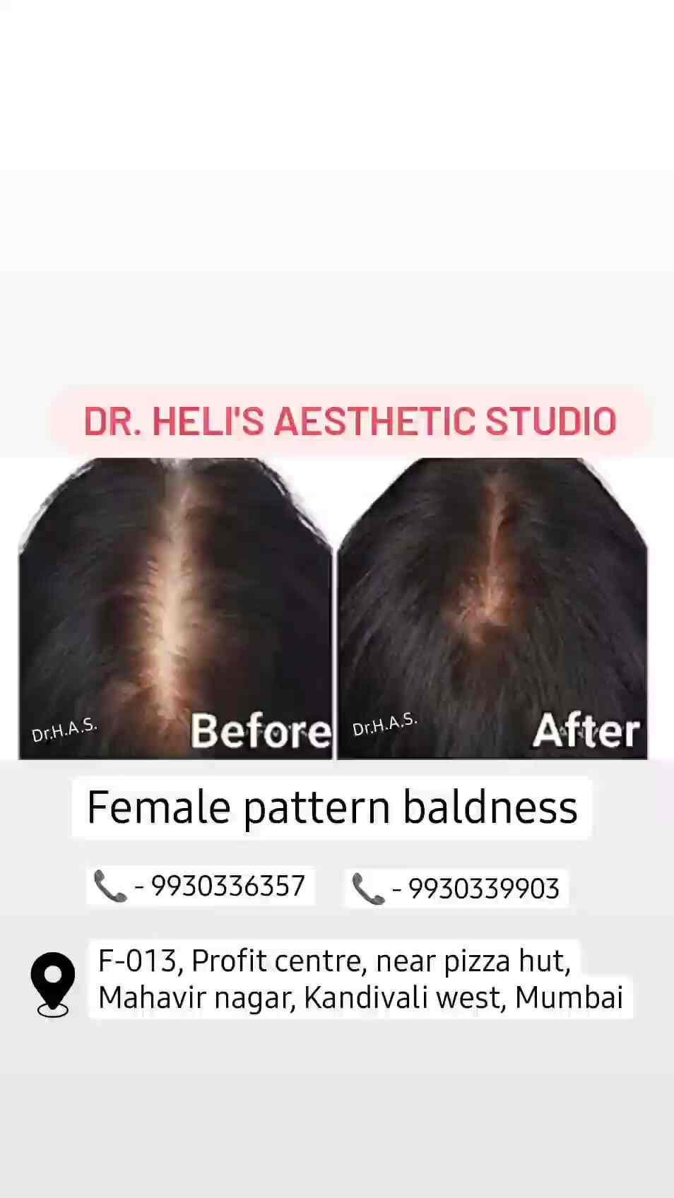 Dr.Heli's Aesthetic Clinic in Kandivali West,Mumbai Best Skin Care