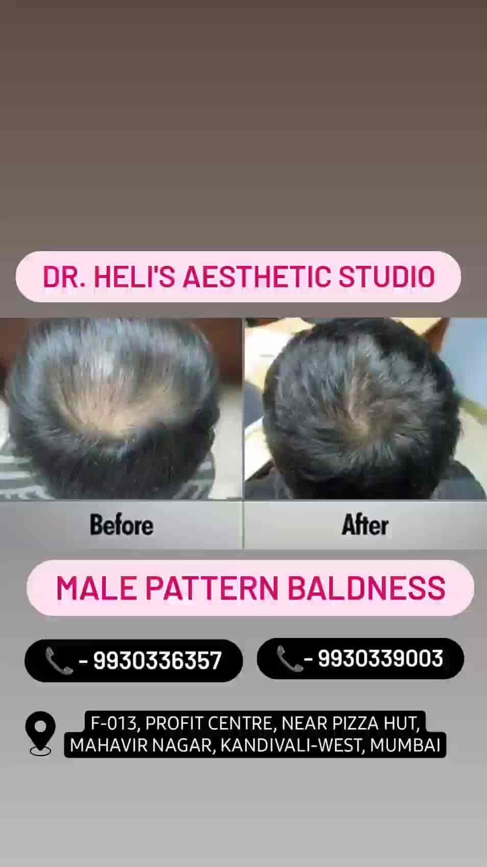 Dr.Heli's Aesthetic Clinic in Kandivali West,Mumbai Best Skin Care