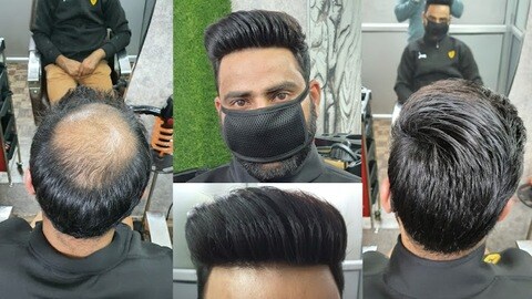 Anas Sheikh Hair Solution in Andheri East - Best Hair Transplant Clinics in Mumbai - Justdial Anas Sheikh Hair Solution in Andheri East - Best Hair Transplant Clinics in Mumbai - Justdial