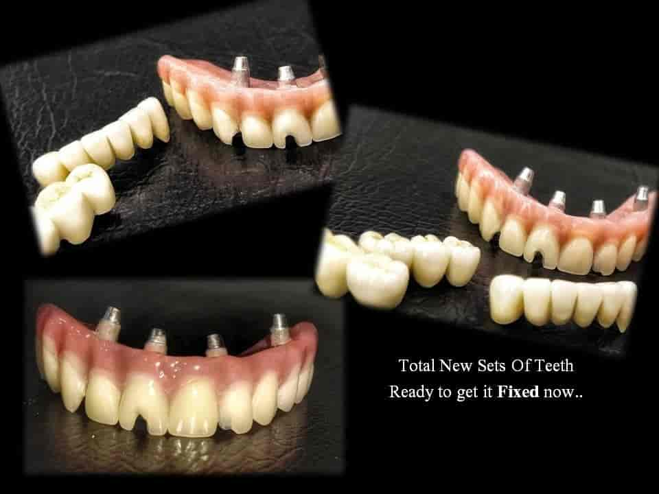 Bhaktamar The Dental Clinic in Bhoiwada-Parel,Mumbai - Best Dental ...