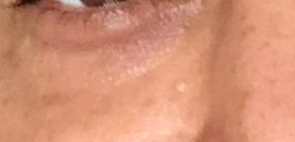 Dr. Agneesh Patial in Andheri West, Mumbai