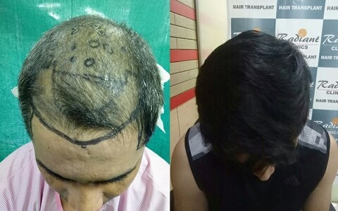Radiant Aesthetics in Andheri West - Best Hair Transplant Clinics in Mumbai - Justdial Radiant Aesthetics in Andheri West - Best Hair Transplant Clinics in Mumbai - Justdial