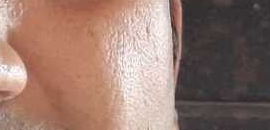 Dr Shashikant Mhashal in Juhu, mumbai