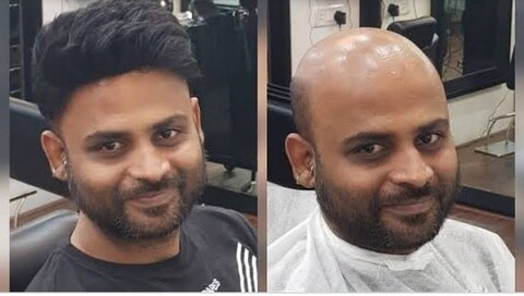 Ratan Hair Wigs Replacement System Centre in Mulund West - Best Hair Weaving Services in Mumbai - Justdial Ratan Hair Wigs Replacement System Centre in Mulund West - Best Hair Weaving Services in Mumbai - Justdial