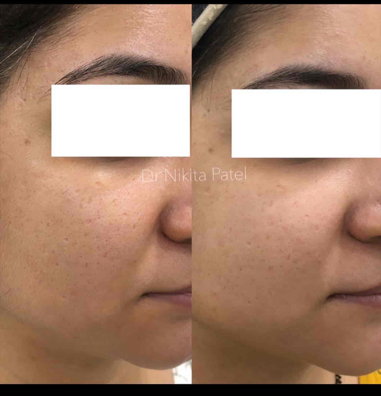 Top Dermatologists in Vartak NagarThane West, Mumbai Best Skin