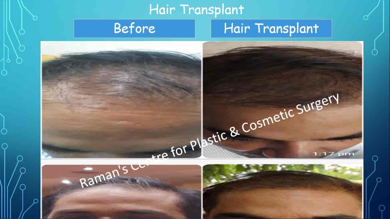Raman's Centre For Plastic & Cosmetic Surgery in New Colony,Muzaffarpur