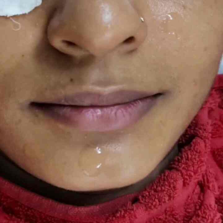 Top Dermatologists in Mominpura, Nagpur Best Skin Specialist near me