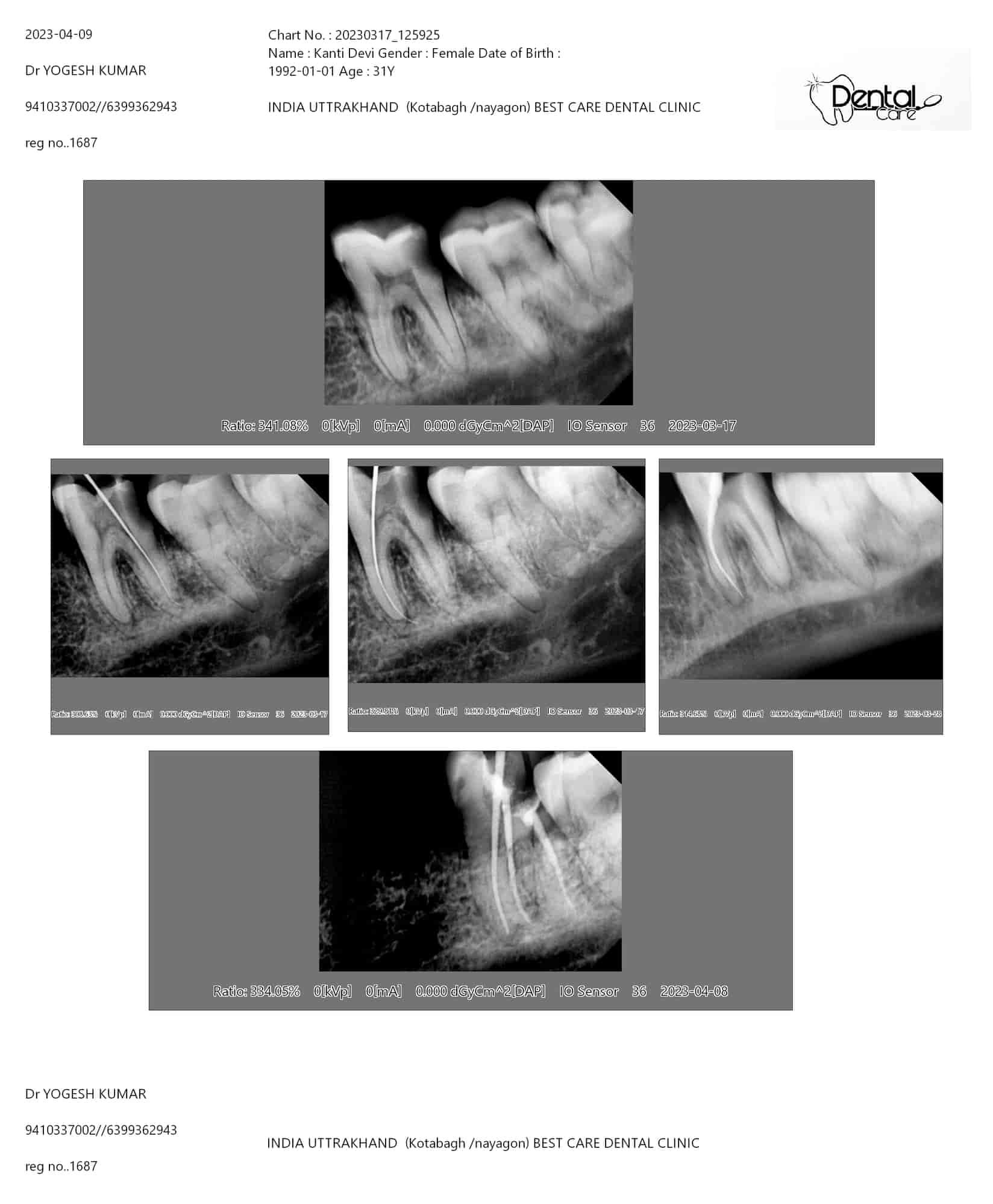 List of nearest Dental X Ray Centres in Munsiari, Pithoragarh
