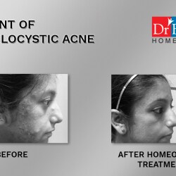 Dr Batra's Healthcare in College Road,Nashik - Best Homeopathic Doctors in Nashik - Justdial Dr Batra's Healthcare in College Road,Nashik - Best Homeopathic Doctors in Nashik - Justdial