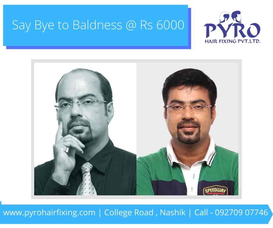 Pyro Hair Fixing Private Limited in College Road,Nashik Best Men