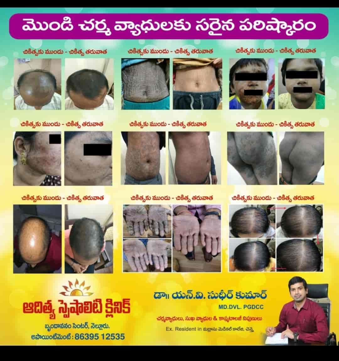 Sudheer Skin And Cosmetic Clinic (Ap Multispeciality Hospital) in