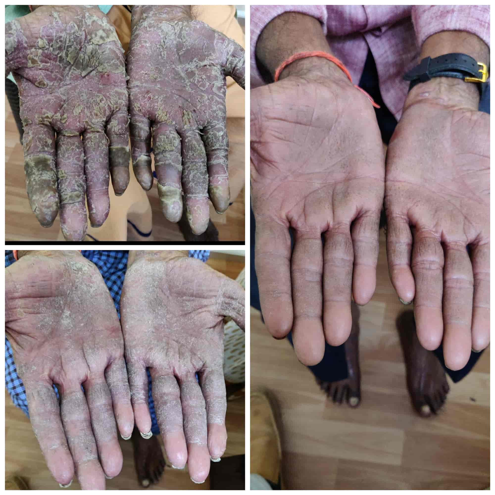 Sudheer Skin And Cosmetic Clinic (Ap Multispeciality Hospital) in