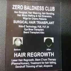 Sareen Hair Clinic Pvt Ltd in Noida Sector 18 - Best Hair Treatment Clinics in Delhi - Justdial Sareen Hair Clinic Pvt Ltd in Noida Sector 18 - Best Hair Treatment Clinics in Delhi - Justdial