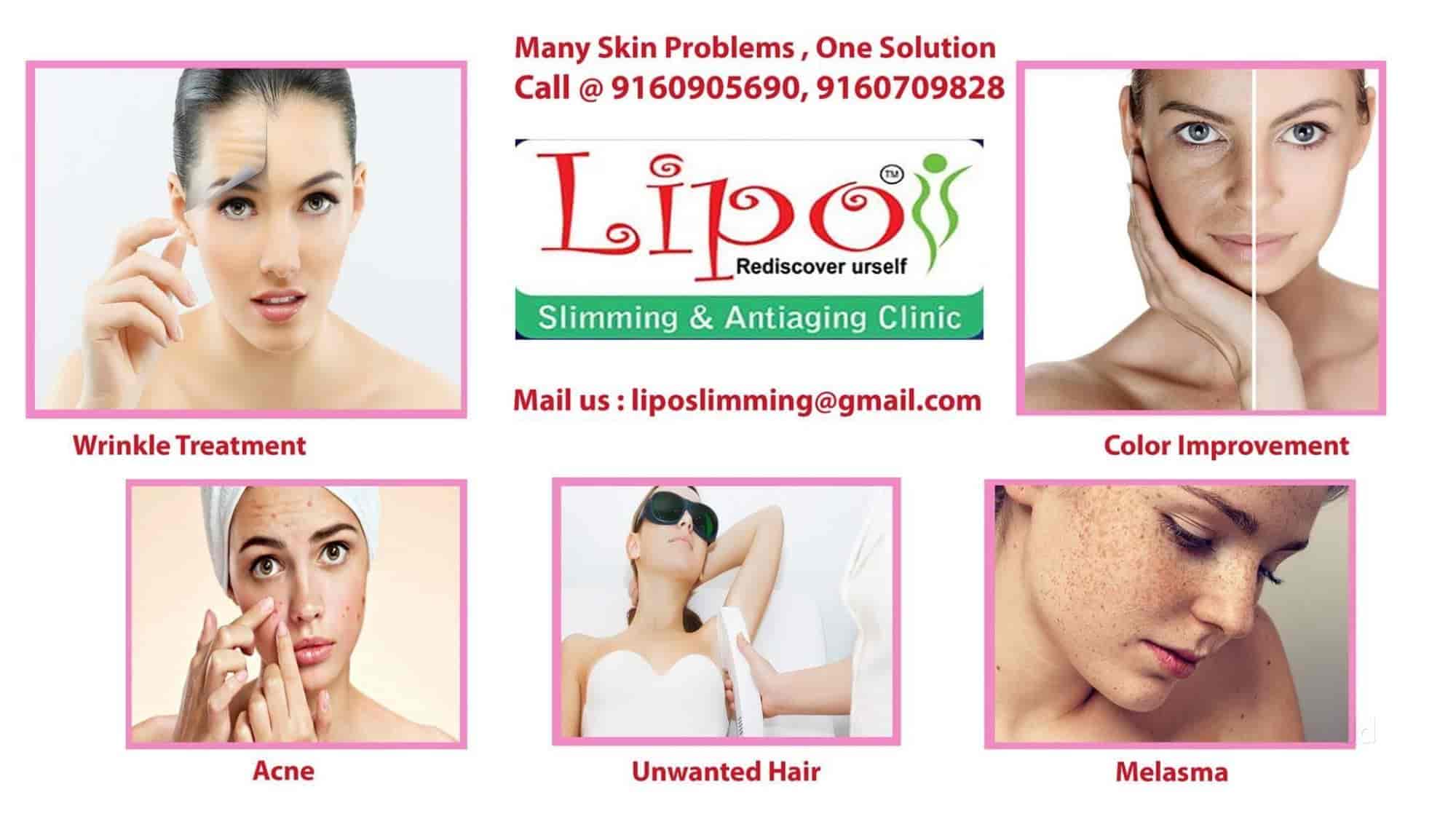Lipo Mediskin & Hospitals in Ongole Road,Ongole Best Hospitals in