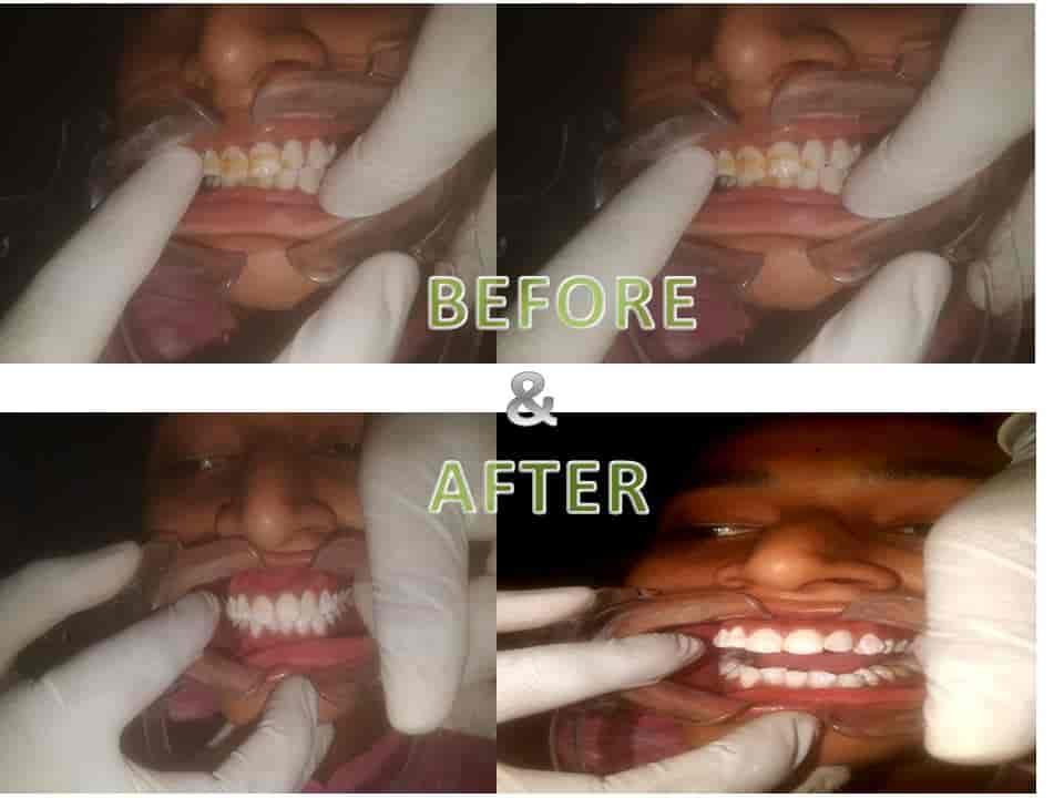 Rainbow Dental Care in Pandaripuram,Ongole Best Dental Hospitals in