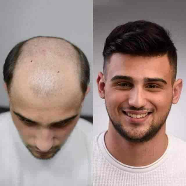 Top Beauty Clinics For Hair Weaving In Sardar Patel Nagar Best