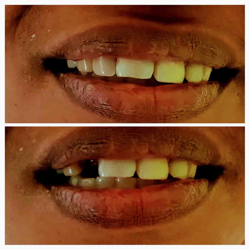 Top Dental Clinics in Pathanamthitta near me Justdial