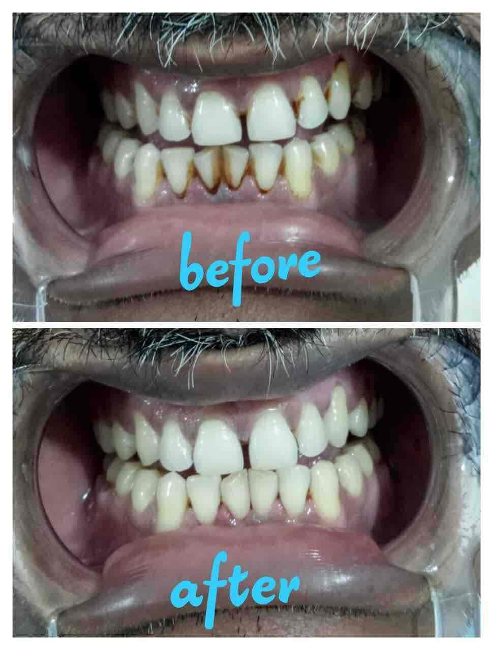 Nishant Dental Care Dentists Book Appointment Online Dentists In Shivpuri Patna Justdial