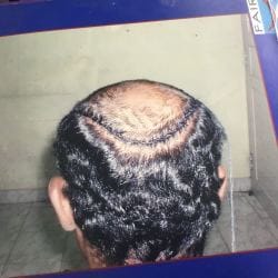 Fair and Hair Health and Beauty Cure P in Mudaliarpet - Best Hair Stylists in Pondicherry - Justdial Fair and Hair Health and Beauty Cure P in Mudaliarpet - Best Hair Stylists in Pondicherry - Justdial