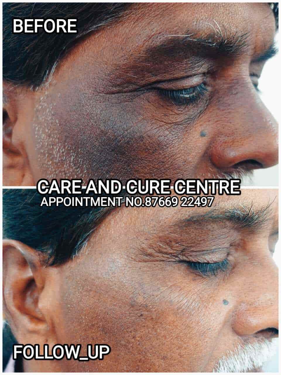 Top Dermatologists near Adarsh HospitalKondhwa Budruk, Pune Best