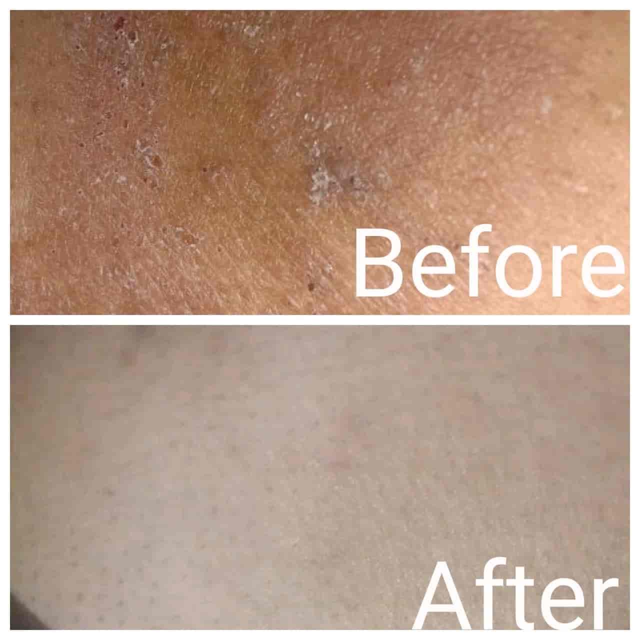 Top Dermatologists near Adarsh HospitalKondhwa Budruk, Pune Best