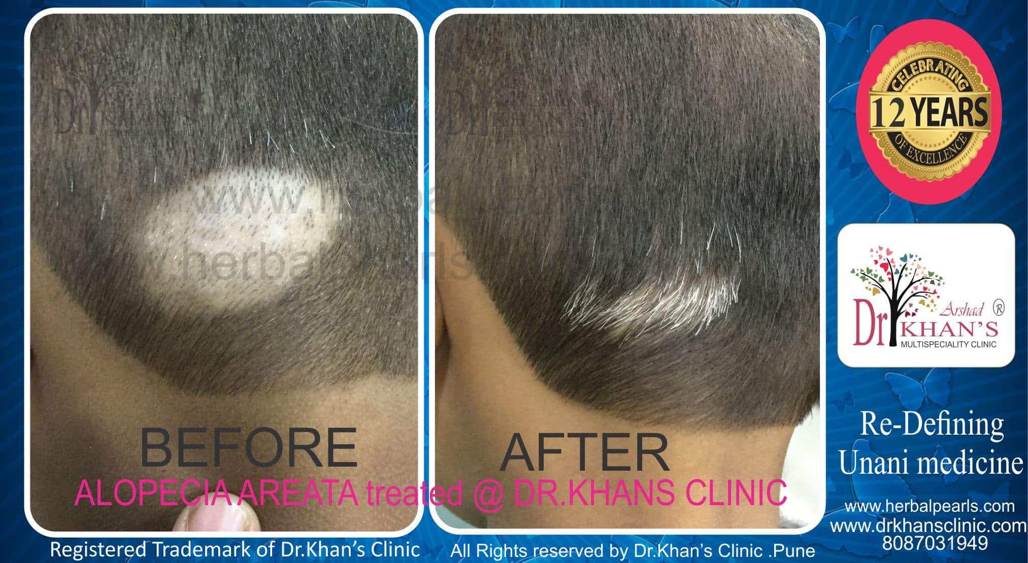 Eczema Clinic in Hadapsar,Pune Best Skin Care Clinics in Pune Justdial