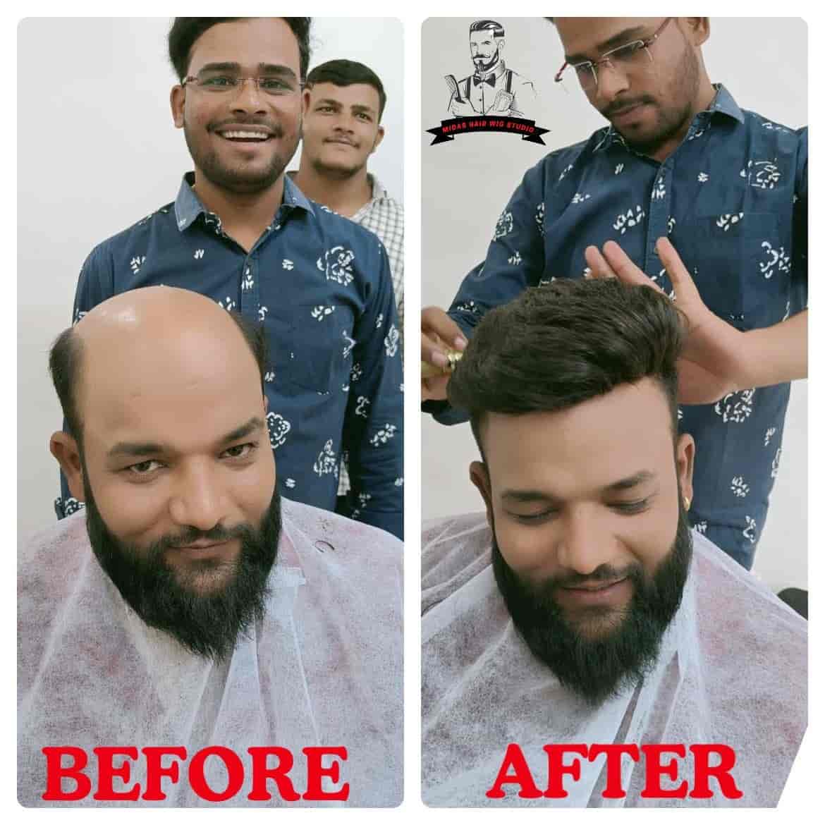 Midas Hair Wig Studio in Akurdi,Pune - Best Miraj Hair Wig Dealers in Pune  - Justdial