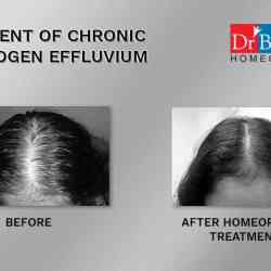 Dr. Batras Healthcare in Pimpri - Book Appointment Online - Best Paediatricians in Pune - Justdial Dr. Batras Healthcare in Pimpri - Book Appointment Online - Best Paediatricians in Pune - Justdial