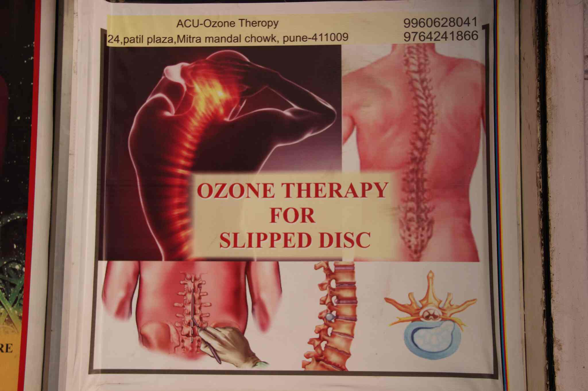Top Acupressure Training Centres in Wakad Best Accupressure