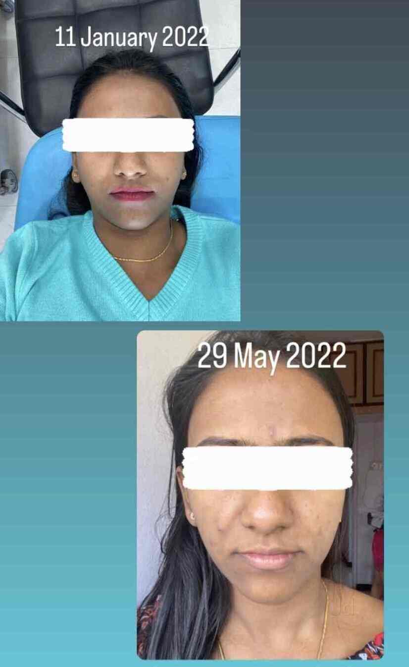 Top Dermatologists near Symbiosis HospitalLavale, Pune Best Skin