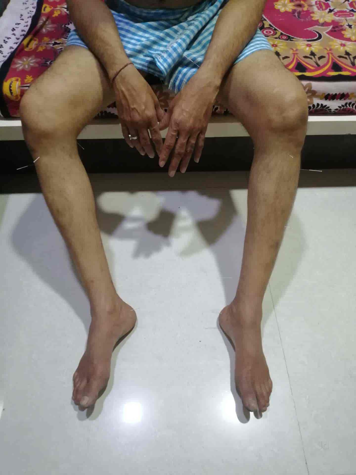 Top Acupressure Training Centres in Wakad Best Accupressure