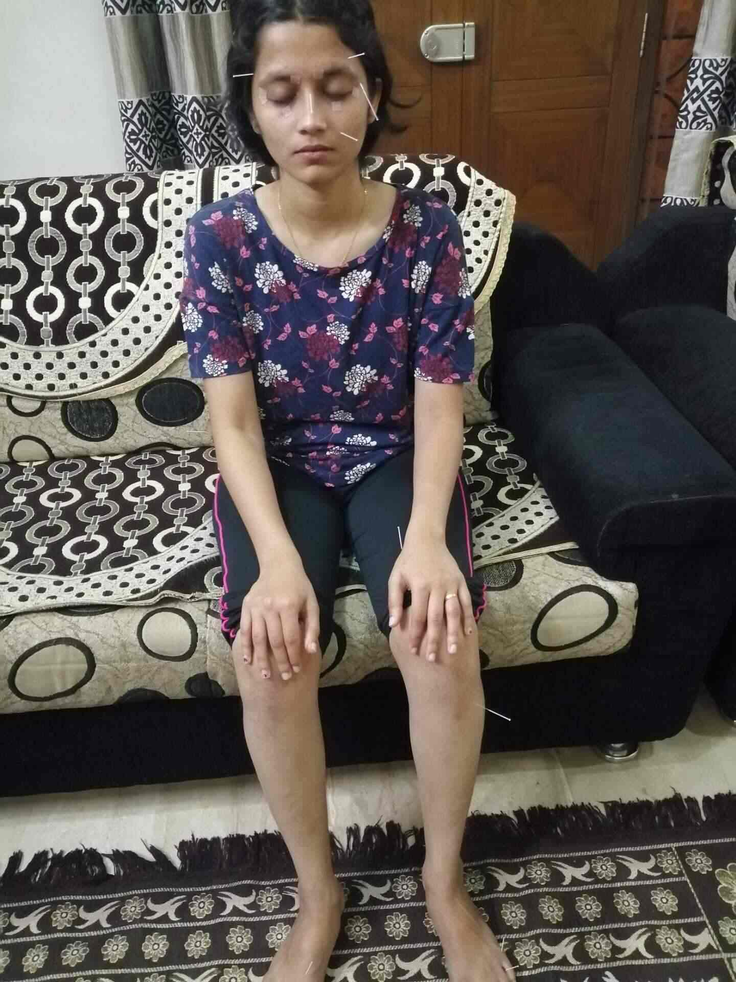 Top Acupressure Training Centres in Wakad Best Accupressure