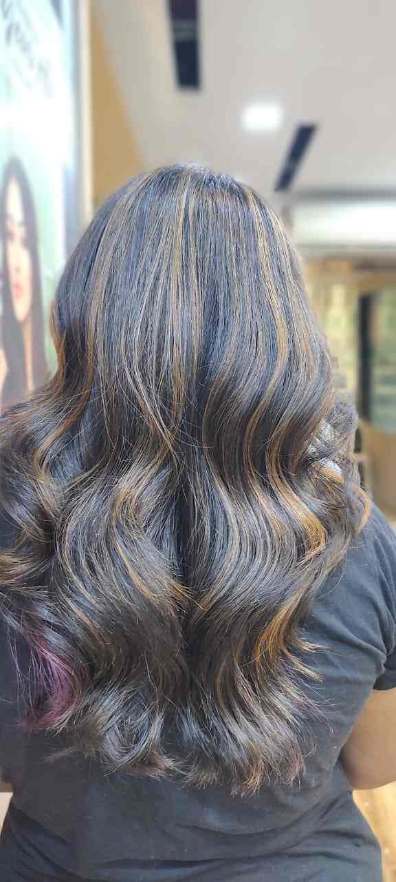 Alopecia Areata Hair Loss – Causes, Symptoms, & Treatments
