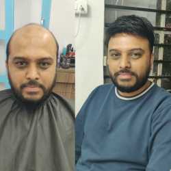 The Patrick Hair Replacement Studio and Salon in Viman Nagar,Pune - Best Wig Dealers in Pune - Justdial The Patrick Hair Replacement Studio and Salon in Viman Nagar,Pune - Best Wig Dealers in Pune - Justdial