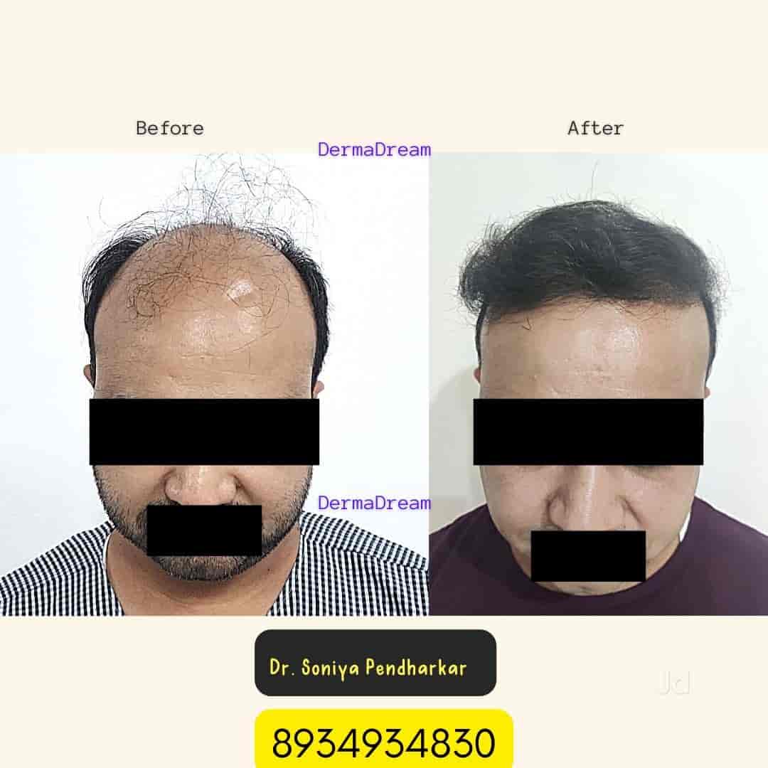 List Of Best Hair Transplant Doctors in Rajgarh - Best Hair Transplant Clinics - Book Appointment Online - Justdial List Of Best Hair Transplant Doctors in Rajgarh - Best Hair Transplant Clinics - Book Appointment Online - Justdial