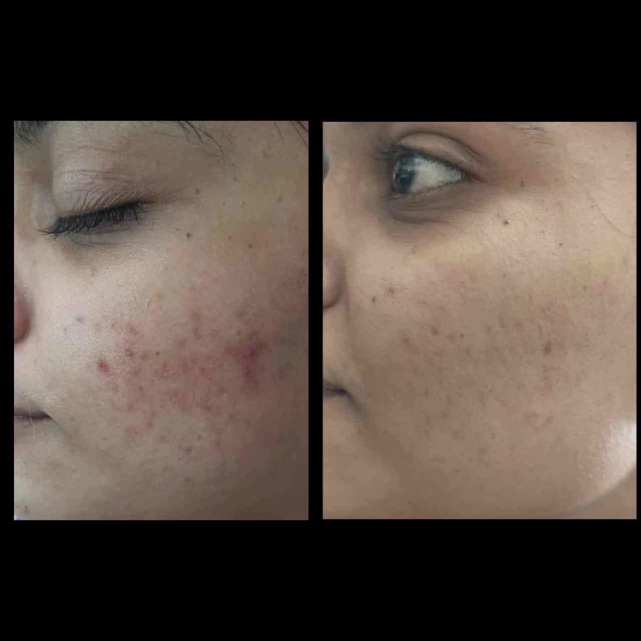 Cutis Skin Hair & Laser Clinic in Above Khesvi Supermarket, Patidar