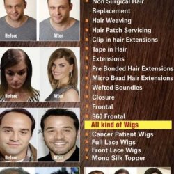 Wig House in Main Road,Ranchi - Best Hair Transplant Clinics in Ranchi - Justdial Wig House in Main Road,Ranchi - Best Hair Transplant Clinics in Ranchi - Justdial