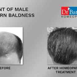 Dr Batras Healthcare in Rewa City - Book Appointment Online - Best Gynaecologist & Obstetrician Doctors in Rewa - Justdial Dr Batras Healthcare in Rewa City - Book Appointment Online - Best Gynaecologist & Obstetrician Doctors in Rewa - Justdial