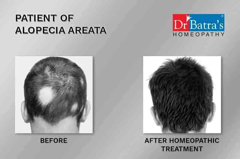 dr_batras_hisar | Hisar