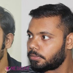 New Look Hair Wig House in Rewari Bus Stand - Best Afro Wig Wholesalers in Rewari - Justdial New Look Hair Wig House in Rewari Bus Stand - Best Afro Wig Wholesalers in Rewari - Justdial