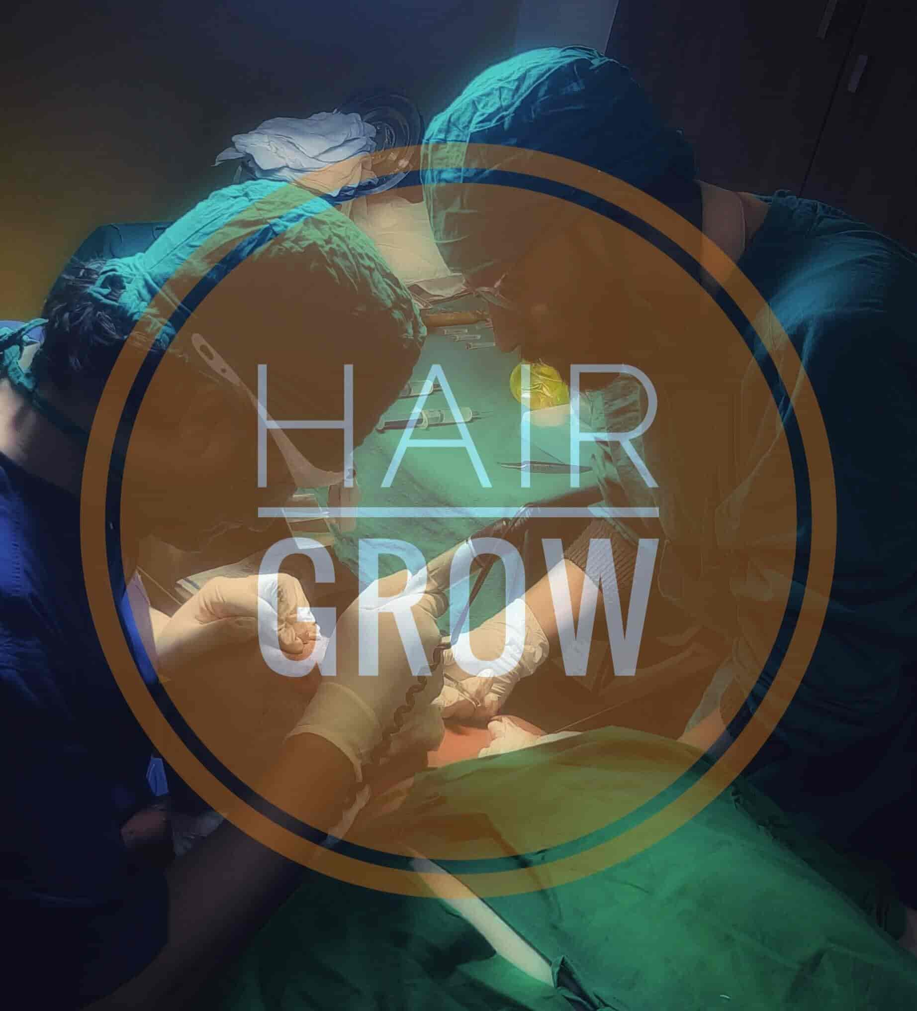 Top Hair Transplant Clinics in Yamunanagar Best Hair Transplant