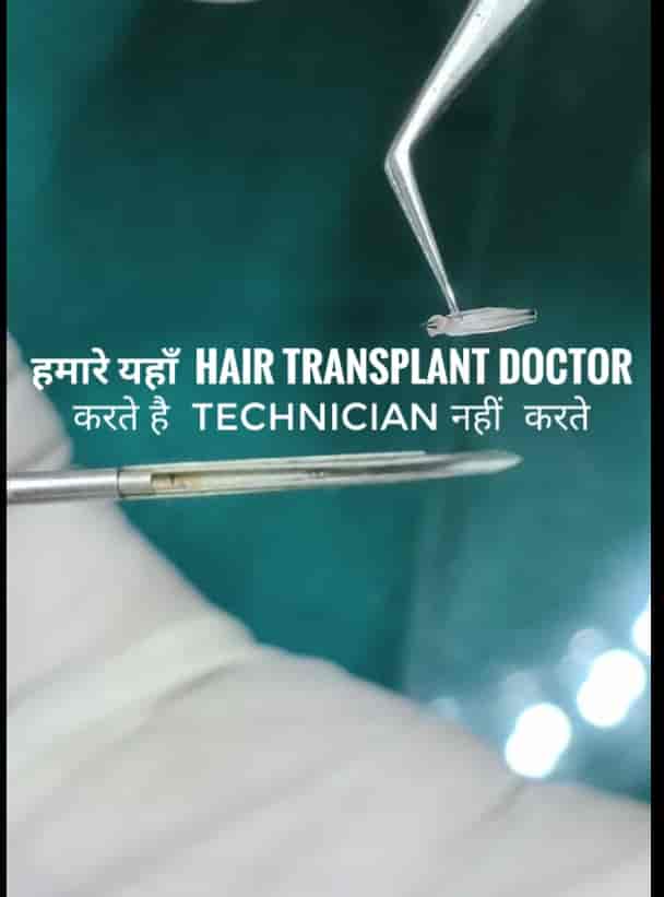 Top Hair Transplant Clinics in Yamunanagar Best Hair Transplant