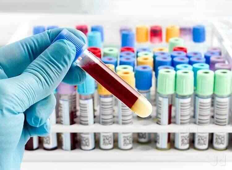 Lab Detail Image